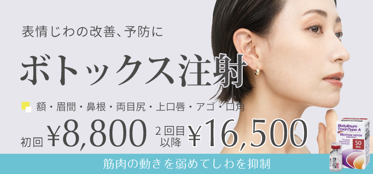 ボトックス注射